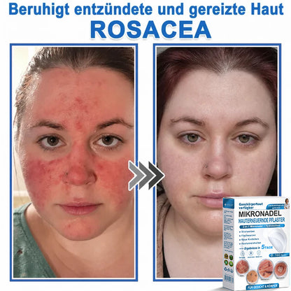 Als glücklicher Kunde haben Sie noch eine Chance, sich bei Ihrem nächsten Einkauf einen Rabatt von 90 % zu sichern! 𝐇𝐢𝐬𝐤𝐢𝐧®