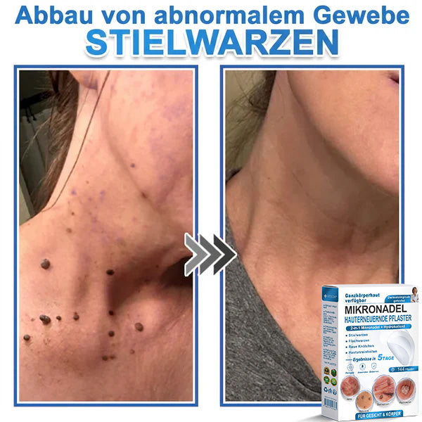Als glücklicher Kunde haben Sie noch eine Chance, sich bei Ihrem nächsten Einkauf einen Rabatt von 90 % zu sichern! 𝐇𝐢𝐬𝐤𝐢𝐧®