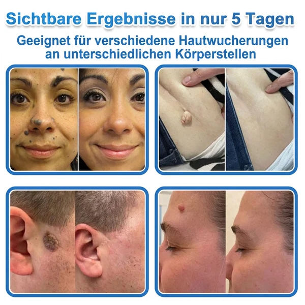 Als glücklicher Kunde haben Sie noch eine Chance, sich bei Ihrem nächsten Einkauf einen Rabatt von 90 % zu sichern! 𝐇𝐢𝐬𝐤𝐢𝐧®