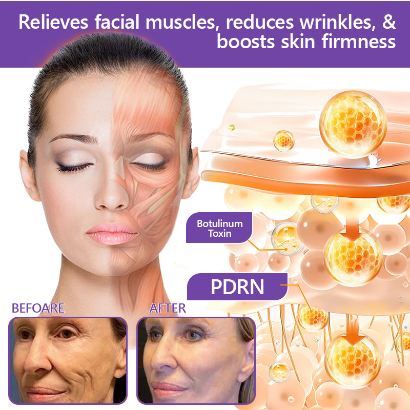 FDA Official: HISKIN® PDRN Multi-Peptide Massaging Body Roller Cream- Anti-aging, Hydrating, Skin Firming & Lifting, Skin Repair, Even Tone, Acne and Dark Spot Treatment, Wart and Mole Removal, and Psoriasis Relief.