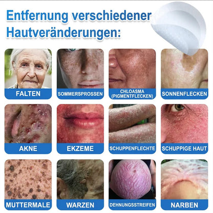 Als glücklicher Kunde haben Sie noch eine Chance, sich bei Ihrem nächsten Einkauf einen Rabatt von 90 % zu sichern! 𝐇𝐢𝐬𝐤𝐢𝐧®