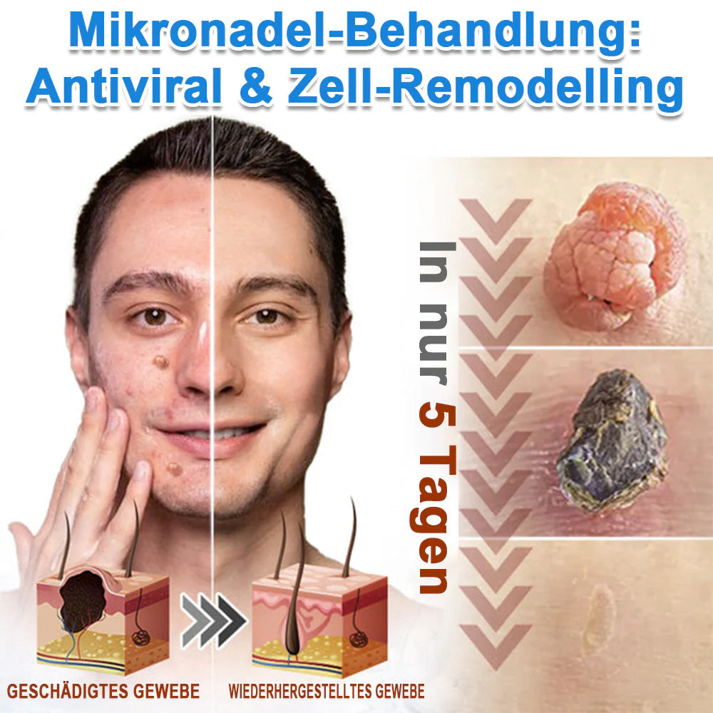 Als glücklicher Kunde haben Sie noch eine Chance, sich bei Ihrem nächsten Einkauf einen Rabatt von 90 % zu sichern! 𝐇𝐢𝐬𝐤𝐢𝐧®