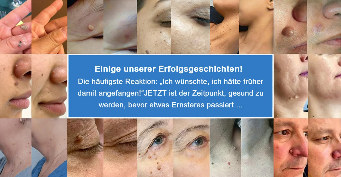 Als glücklicher Kunde haben Sie noch eine Chance, sich bei Ihrem nächsten Einkauf einen Rabatt von 90 % zu sichern! 𝐇𝐢𝐬𝐤𝐢𝐧®