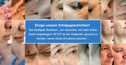 Als glücklicher Kunde haben Sie noch eine Chance, sich bei Ihrem nächsten Einkauf einen Rabatt von 90 % zu sichern! 𝐇𝐢𝐬𝐤𝐢𝐧®