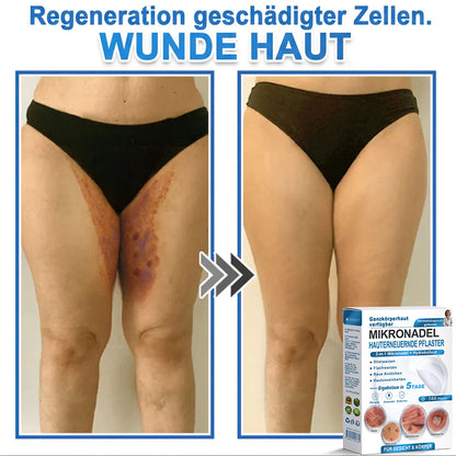Als glücklicher Kunde haben Sie noch eine Chance, sich bei Ihrem nächsten Einkauf einen Rabatt von 90 % zu sichern! 𝐇𝐢𝐬𝐤𝐢𝐧®