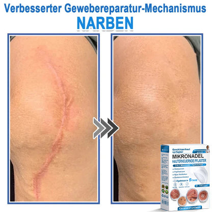 Als glücklicher Kunde haben Sie noch eine Chance, sich bei Ihrem nächsten Einkauf einen Rabatt von 90 % zu sichern! 𝐇𝐢𝐬𝐤𝐢𝐧®
