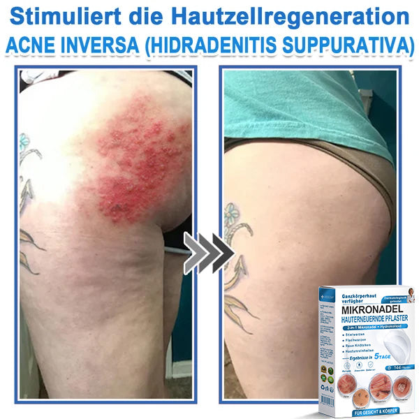 Als glücklicher Kunde haben Sie noch eine Chance, sich bei Ihrem nächsten Einkauf einen Rabatt von 90 % zu sichern! 𝐇𝐢𝐬𝐤𝐢𝐧®
