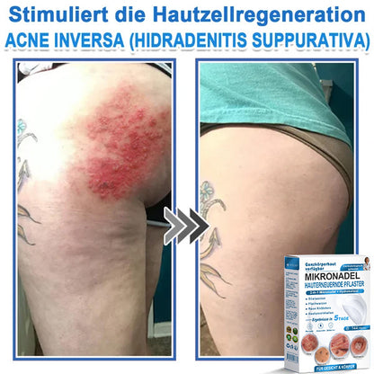 Als glücklicher Kunde haben Sie noch eine Chance, sich bei Ihrem nächsten Einkauf einen Rabatt von 90 % zu sichern! 𝐇𝐢𝐬𝐤𝐢𝐧®