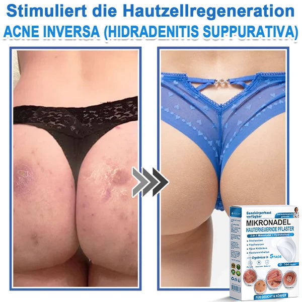 Als glücklicher Kunde haben Sie noch eine Chance, sich bei Ihrem nächsten Einkauf einen Rabatt von 90 % zu sichern! 𝐇𝐢𝐬𝐤𝐢𝐧®