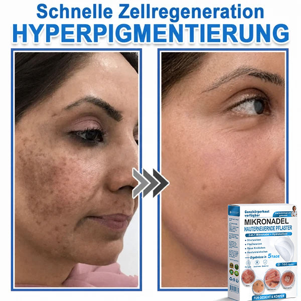 Als glücklicher Kunde haben Sie noch eine Chance, sich bei Ihrem nächsten Einkauf einen Rabatt von 90 % zu sichern! 𝐇𝐢𝐬𝐤𝐢𝐧®